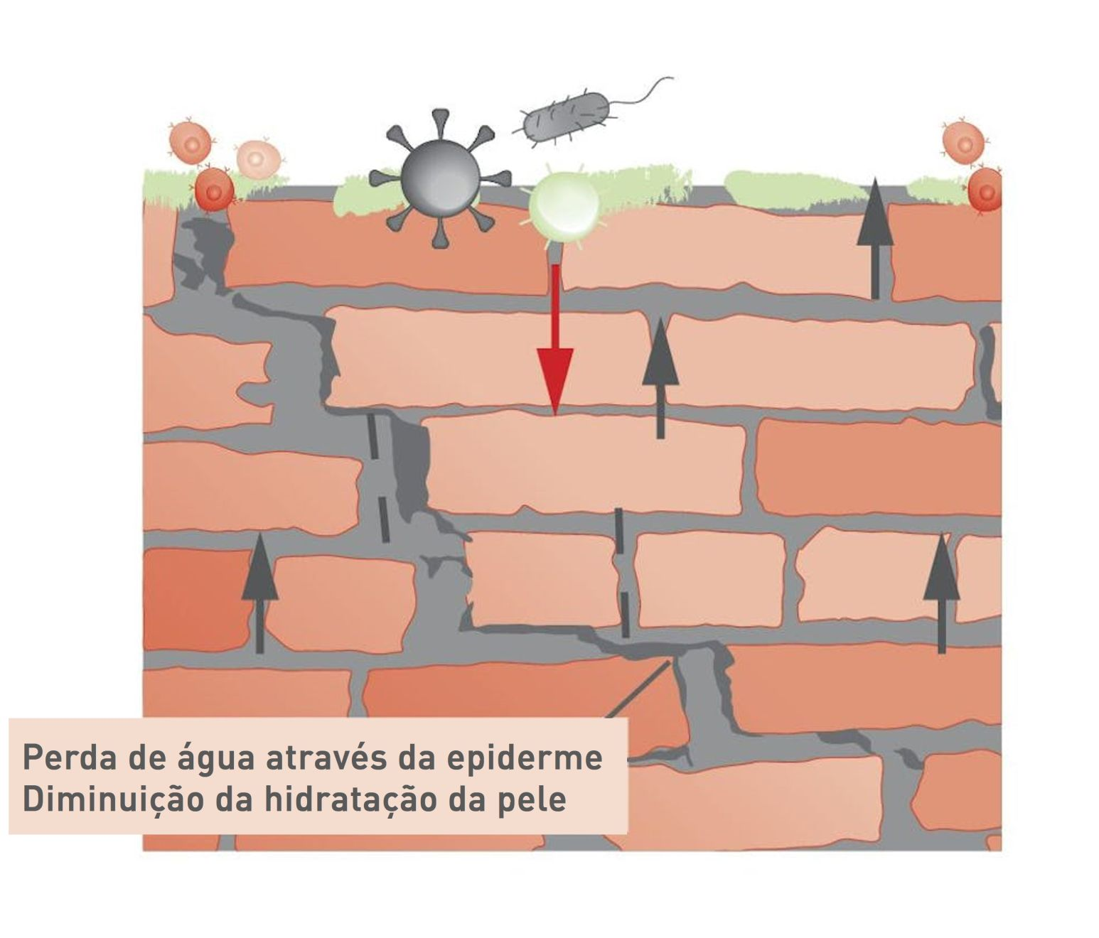 Observe como a barreira lipídica defeituosa pode não ser capaz de impedir a penetração de microrganismos e alérgenos.