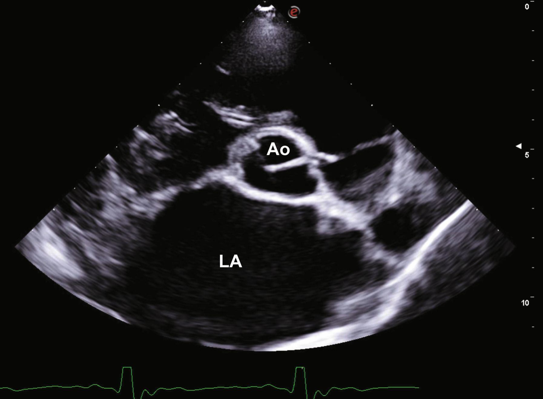 a