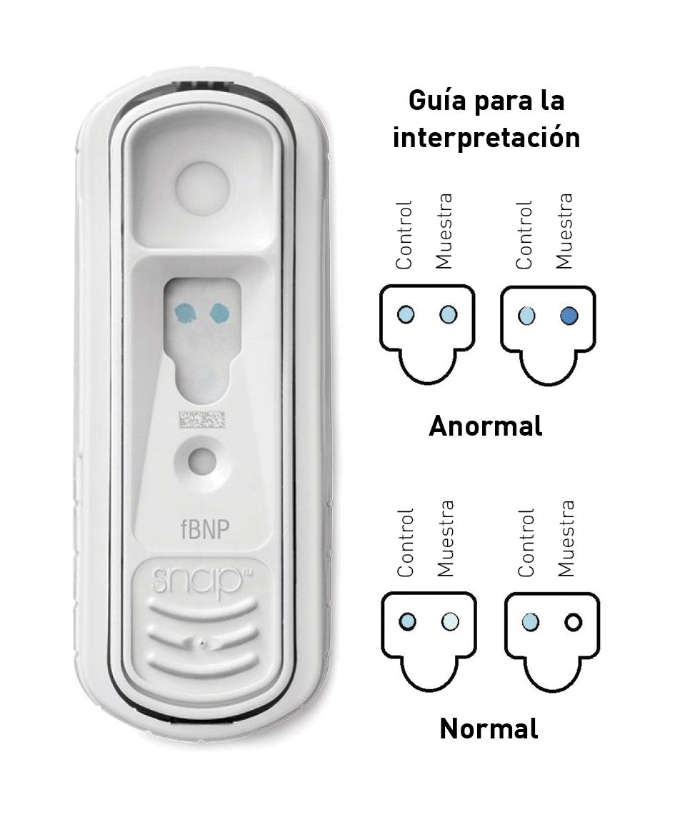 La prueba SNAP® Feline proBNP utiliza la técnica ELISA