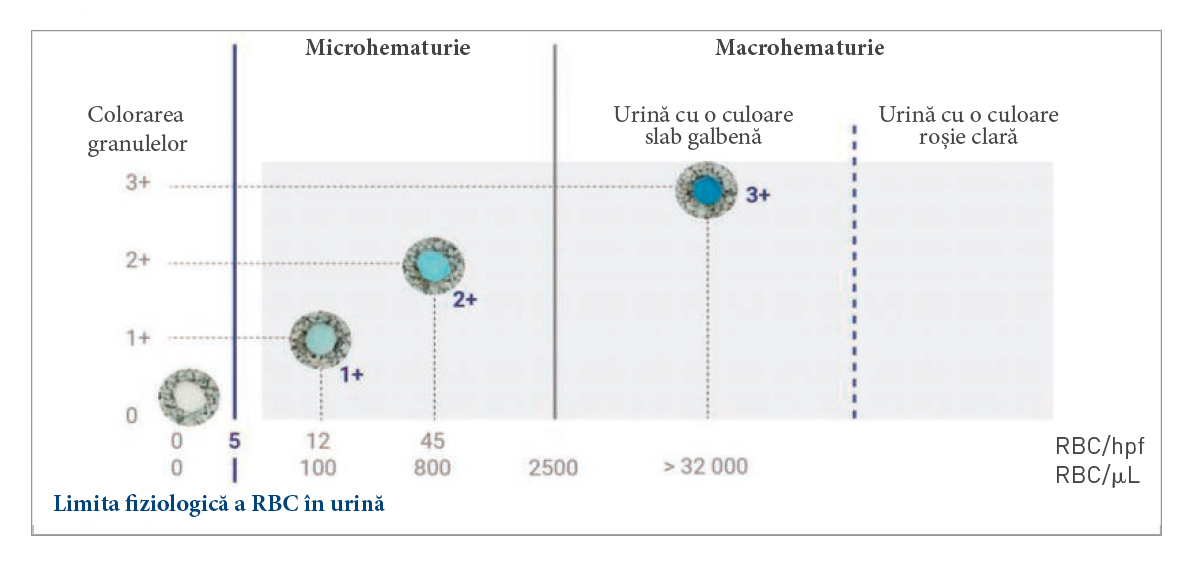 The coloration of the granules will vary according to the concentration of blood in the urine; the image shows the response for a urine sample at pH = 6, USG = 1.026 ( 4 ).