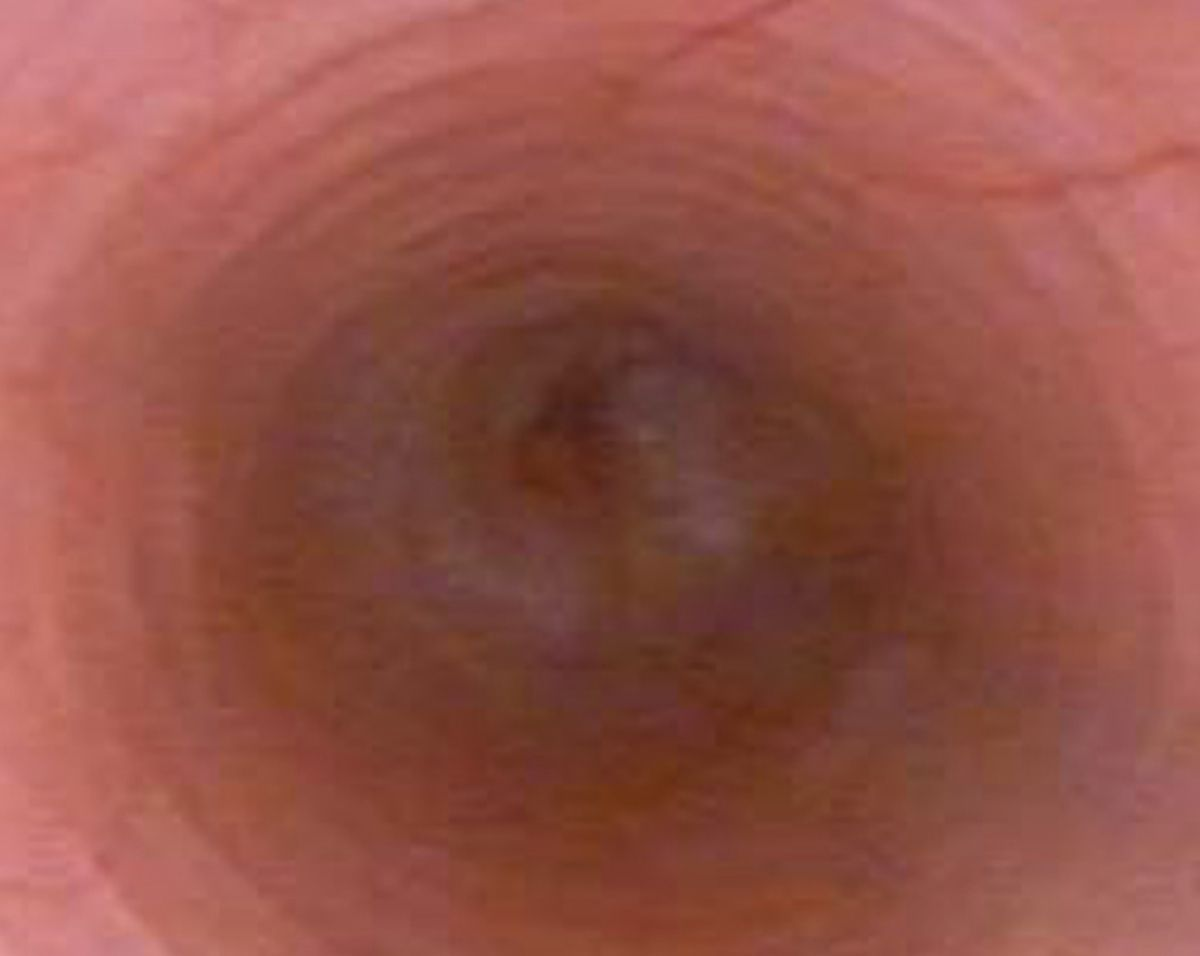 The striations are clearly visible in this photo.