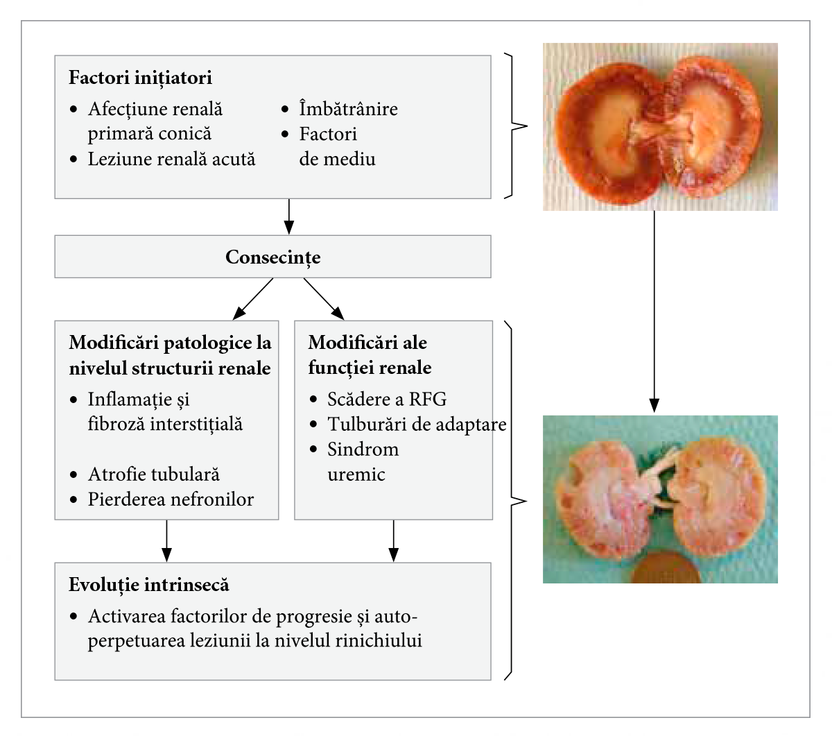 The generally accepted proposed mechanism for initiation and progression of chronic kidney disease. Initiating factors lead to the “consequences”: changes in renal structure and function. As the disease progresses and significant nephron loss occurs, maladaptive responses intrinsic to the cat further contribute to renal damage and nephron loss. Images of the dissected kidney illustrate a healthy kidney (above) and end stage CKD kidney (below).