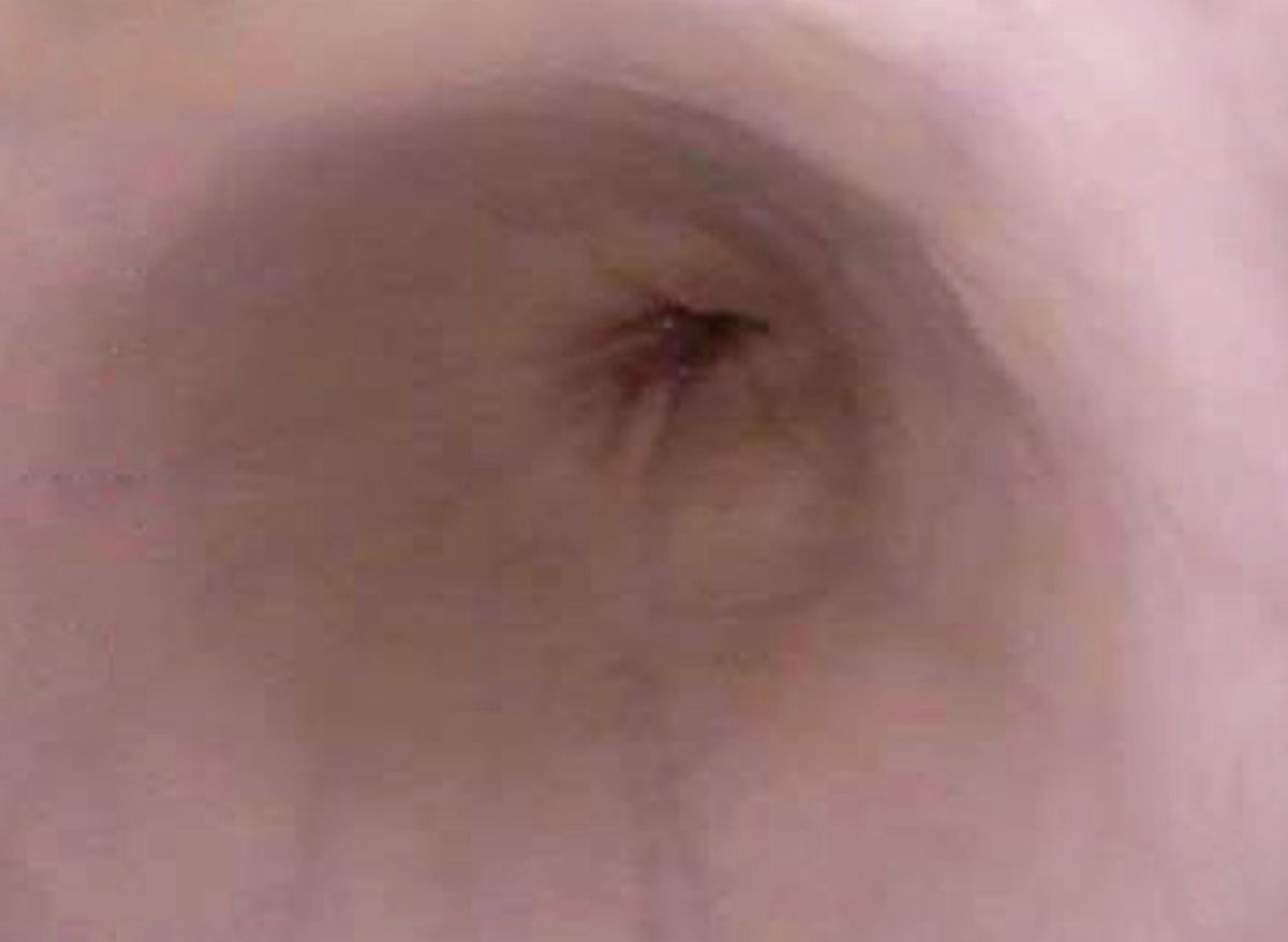 An endoscopic comparison of the distal esophagus of the dog (a) and cat (b).