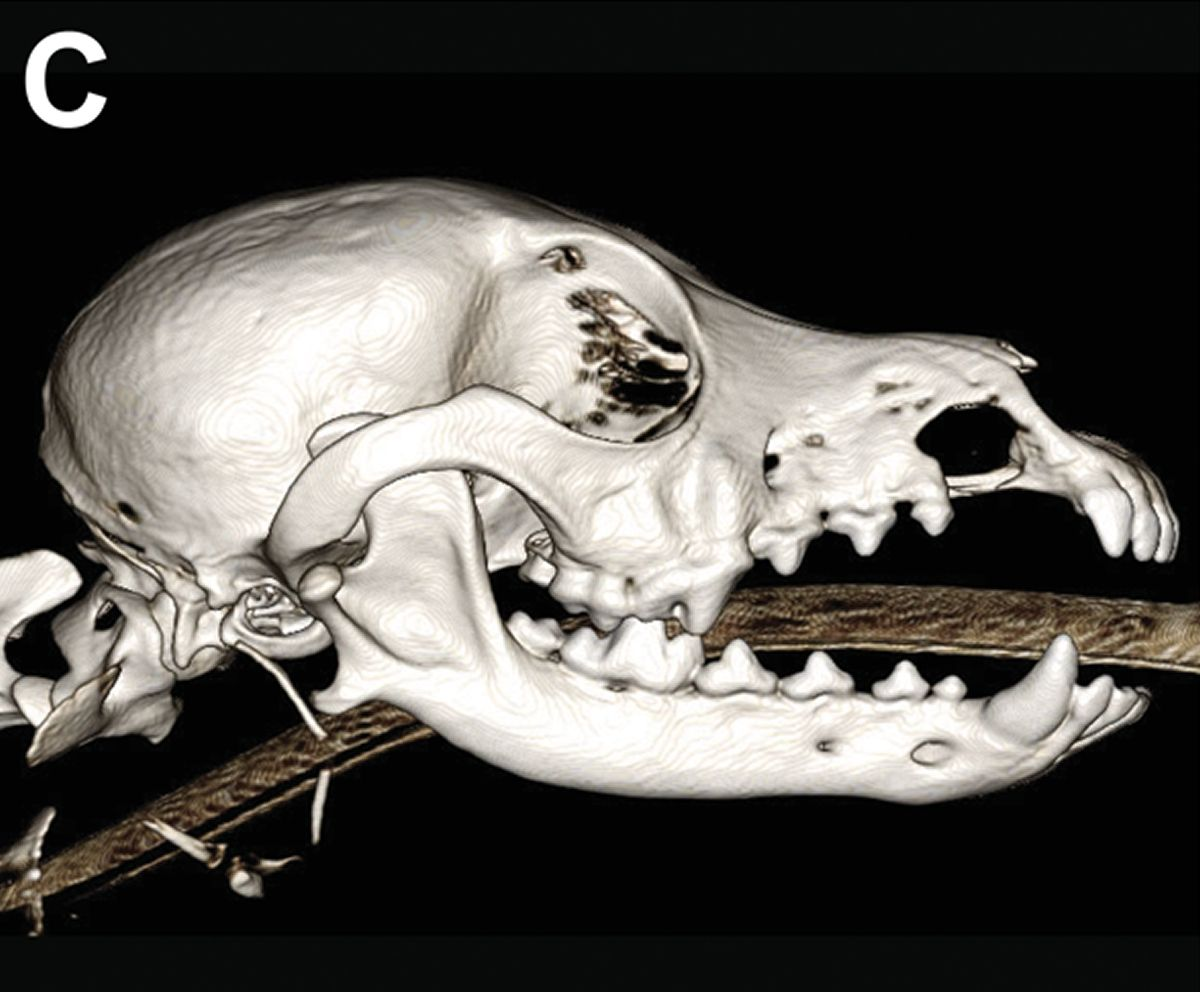 Diese dreidimensionale Rekonstruktion mittels Cone-Beam-Computertomographie zeigt die beträchtliche Ausdehnung des lokalen, scharf abgrenzbaren Knochenverlustes im Bereich der rechten oronasalen Fistel. 