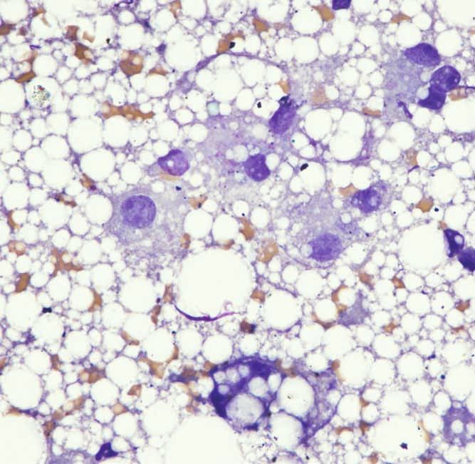Figure 2. Cytologie hépatique chez un chat atteint