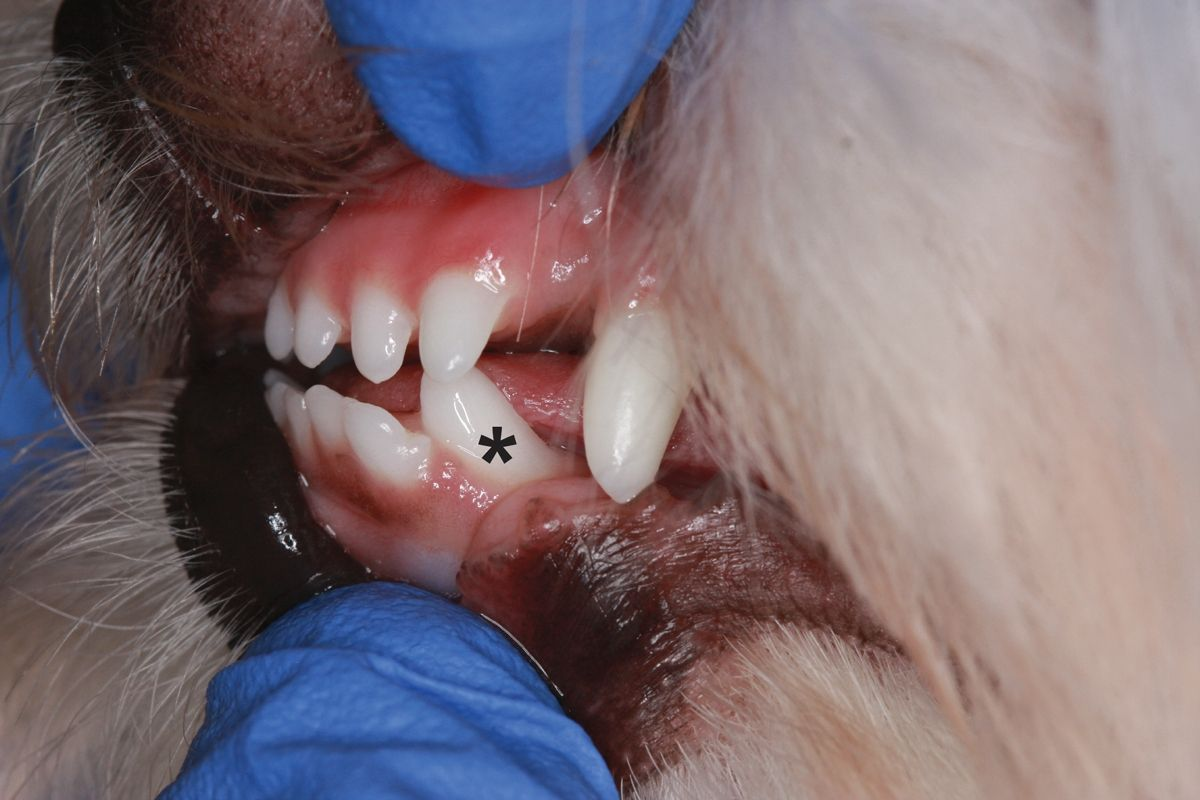 Dents rostrales à gauche chez un Terrier Maltais de 8 mois, présentant une malocclusion squelettique modérée (« en ciseaux » pour les incisives) et une malocclusion dentaire [canine mandibulaire gauche retournée vers l’avant et vers la langue (astérisque), en contact avec la 3e incisive maxillaire gauche et provoquant une buccoversion modérée de cette dent]. 