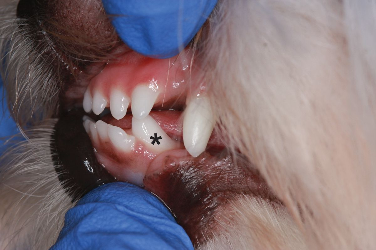 The left rostral teeth in an 8-month-old Maltese Terrier demonstrating mild skeletal malocclusion (“level bite” of the incisor teeth) and dental malocclusion (the rostroverted, linguoverted left mandibular canine tooth [asterisk] is contacting the left maxillary third incisor tooth and causing mild buccoversion of that tooth as a result). 
