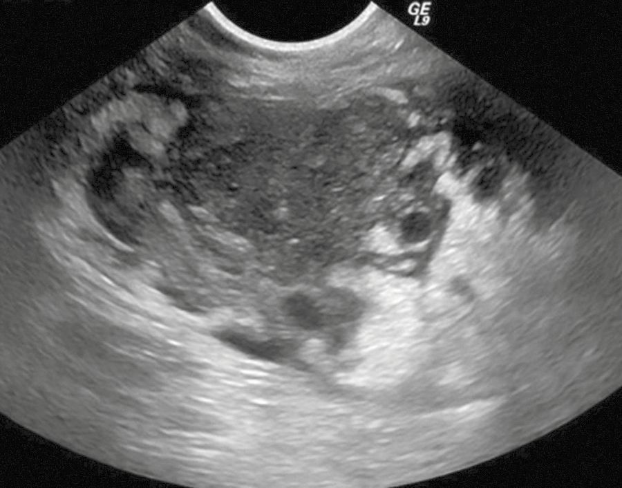A thoracic ultrasound scan 