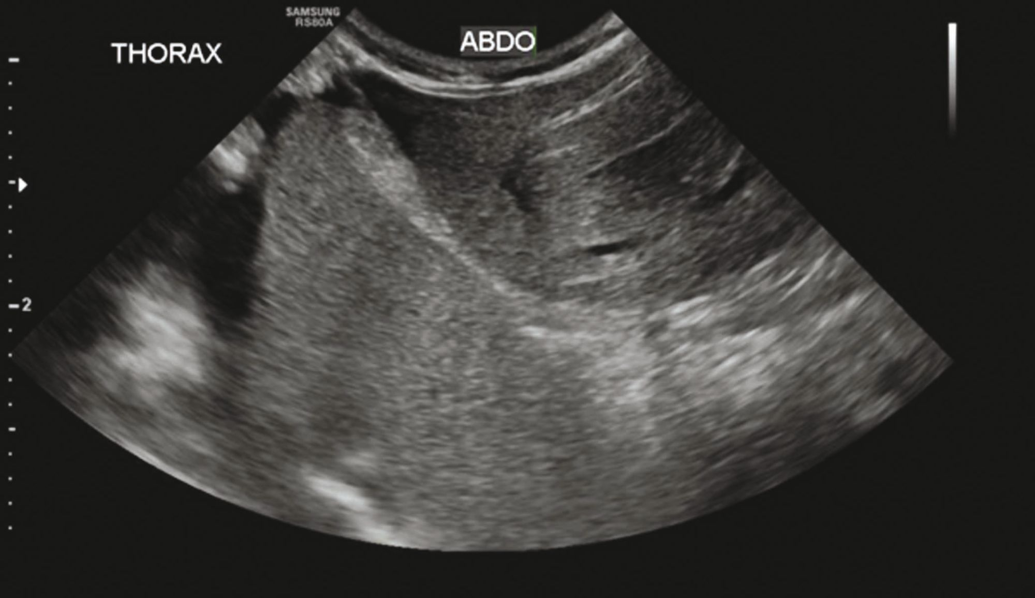 An ultrasound image of a cat 