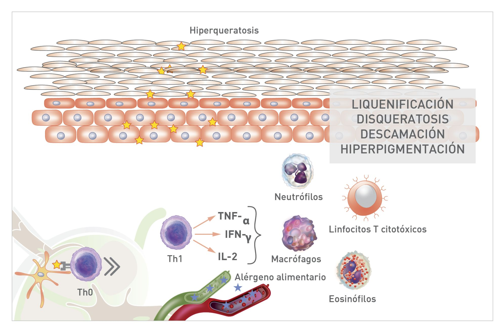 Esquema de la respuesta inflamatoria a los alérgenos alimentarios en la dermatitis atópica crónica canina