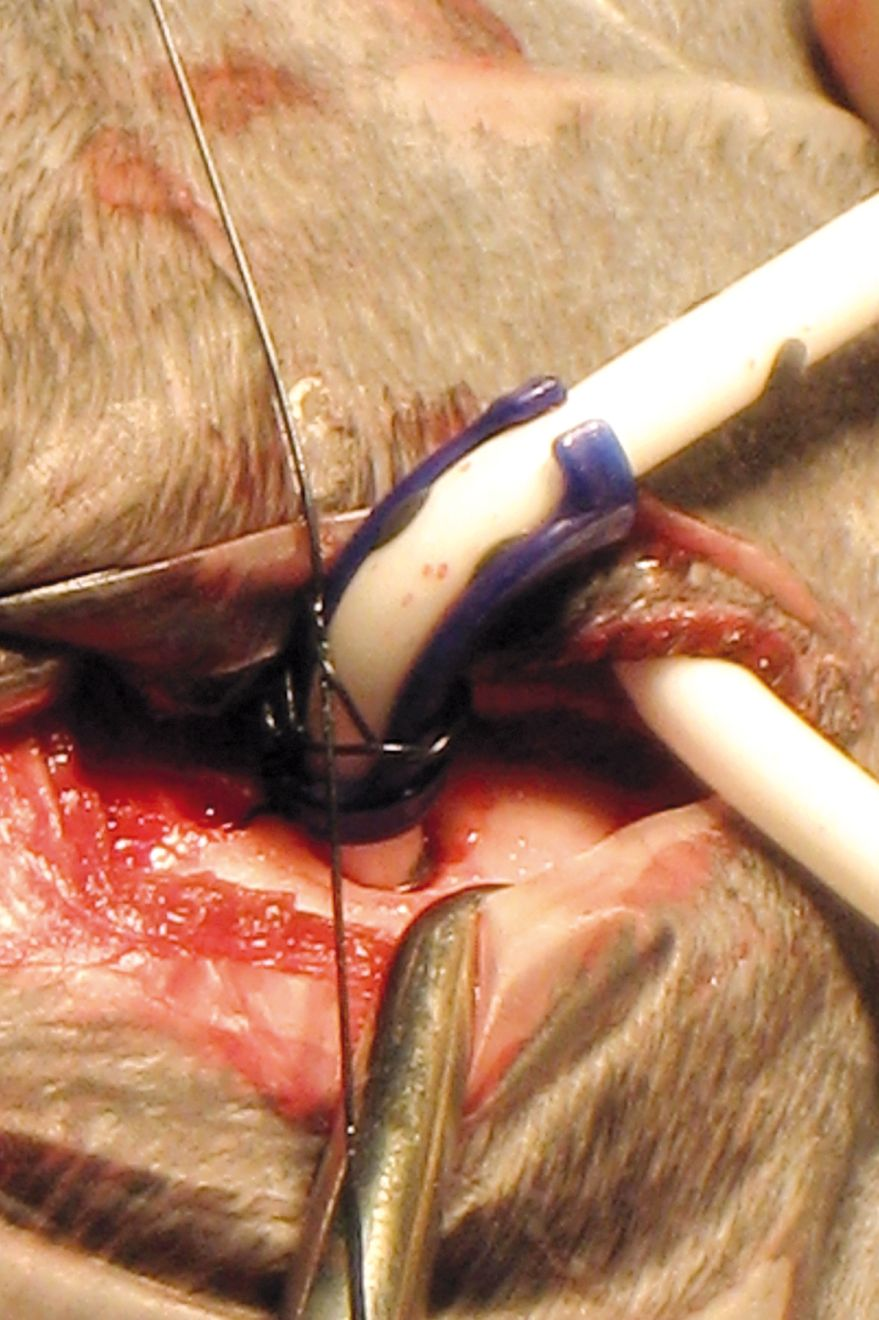 Figure 8. Lors de la chirurgie, le cathéter ventriculaire est fixé au crâne.© William B. Thomas