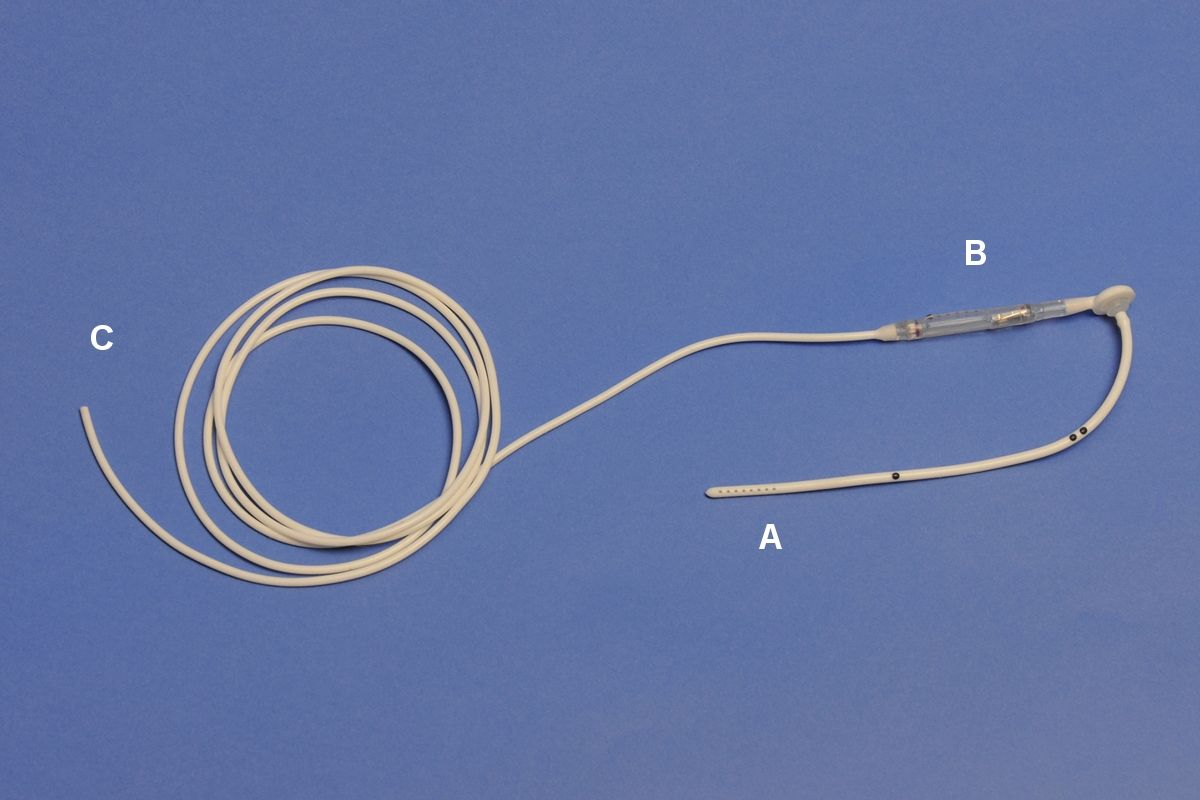 Figure 7. Système de dérivation ventriculo-péritonéale avec cathéter ventriculaire (A), valve (B) et cathéter péritonéal (C).© William B. Thomas