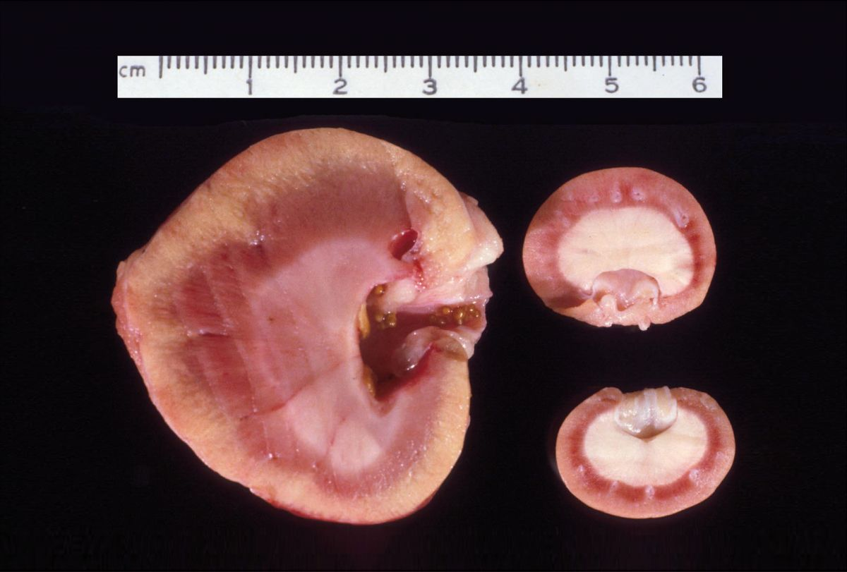 Querschnitt eines Allotransplantats (links) und einer nativen Niere (rechts) bei der Sektion einer 7 Jahre alten, weiblichen, kastrierten Kurzhaarhauskatze, die zwei Jahre nach der Transplantation eine proximale Harnleiterobstruktion infolge einer Calciumoxalaturolithiasis entwickelt hatte.