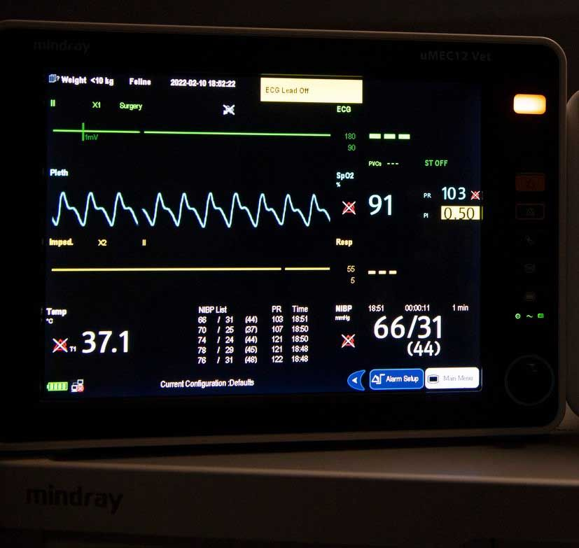 A monitor displays the readout as a continuous pressure wave