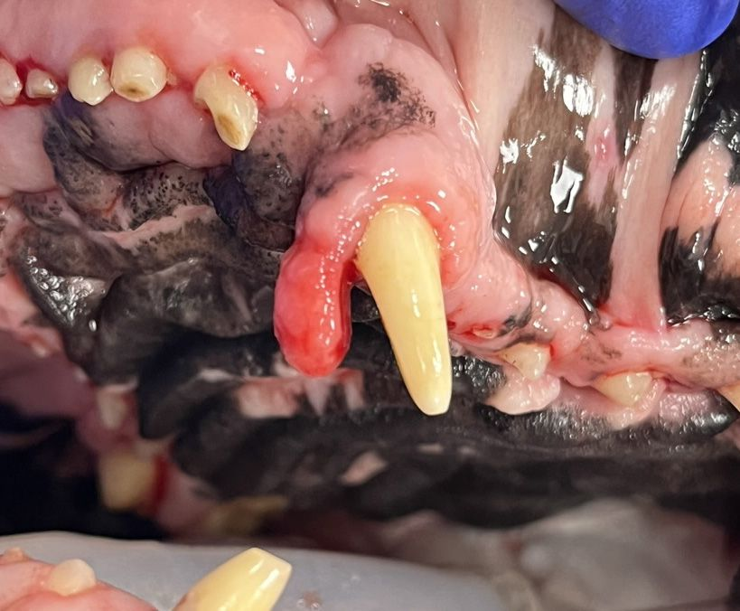 hyperplasie gingivale c
