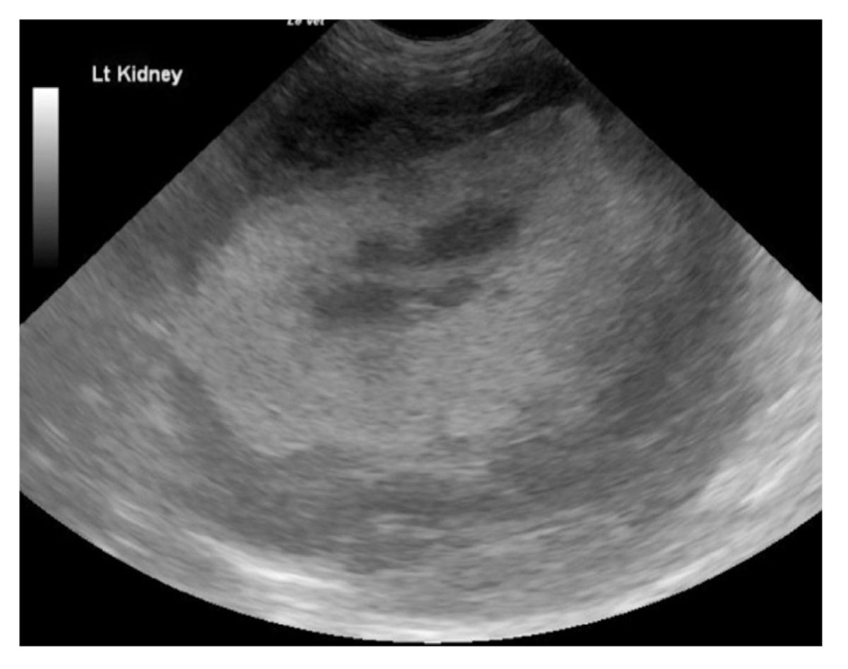 Detection of any abnormal renal architecture, such as alteration in the renal parenchyma, should be investigated further; this includes looking for obvious soft tissue abnormalities in other abdominal organs, assessment of the heart and lungs, and looking for evidence of pleural and pericardial effusion. Both kidneys in this cat showed abnormal architecture.