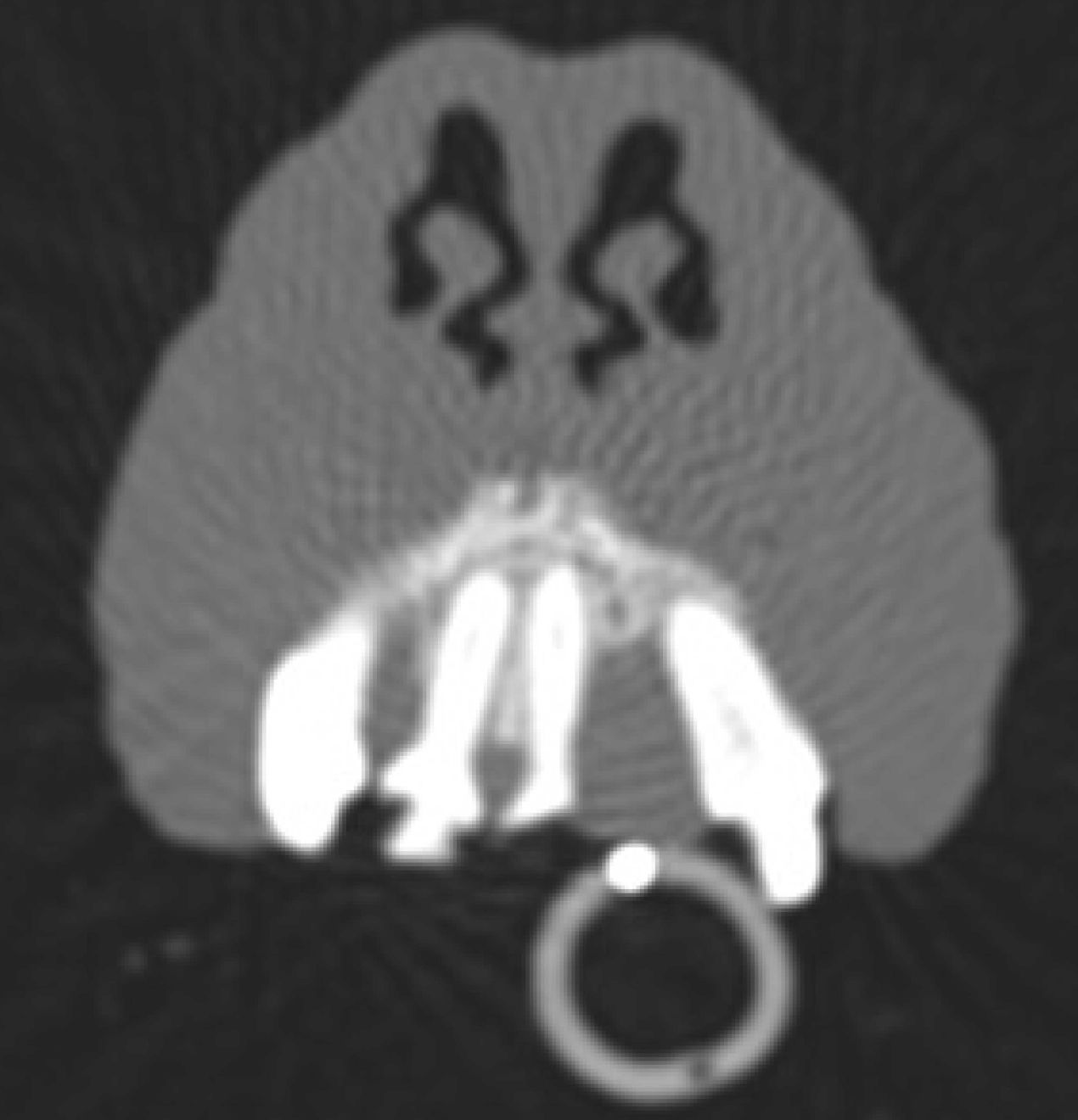 bilan diagnostique des lésions a