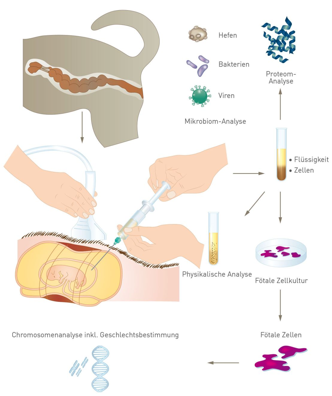 Die Fruchtwasserentnahme eignet sich für verschiedene diagnostische wissenschaftliche Zwecke
