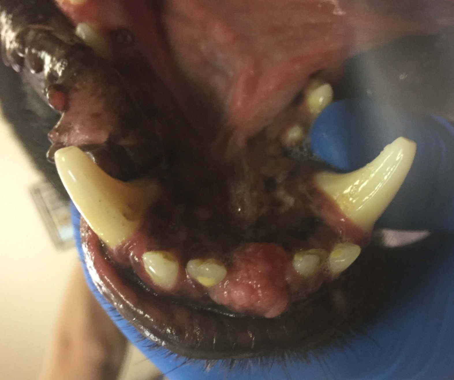 Présence d’une hypertrophie gingivale ronde et de texture irrégulière dans la région des dents 301 et 401