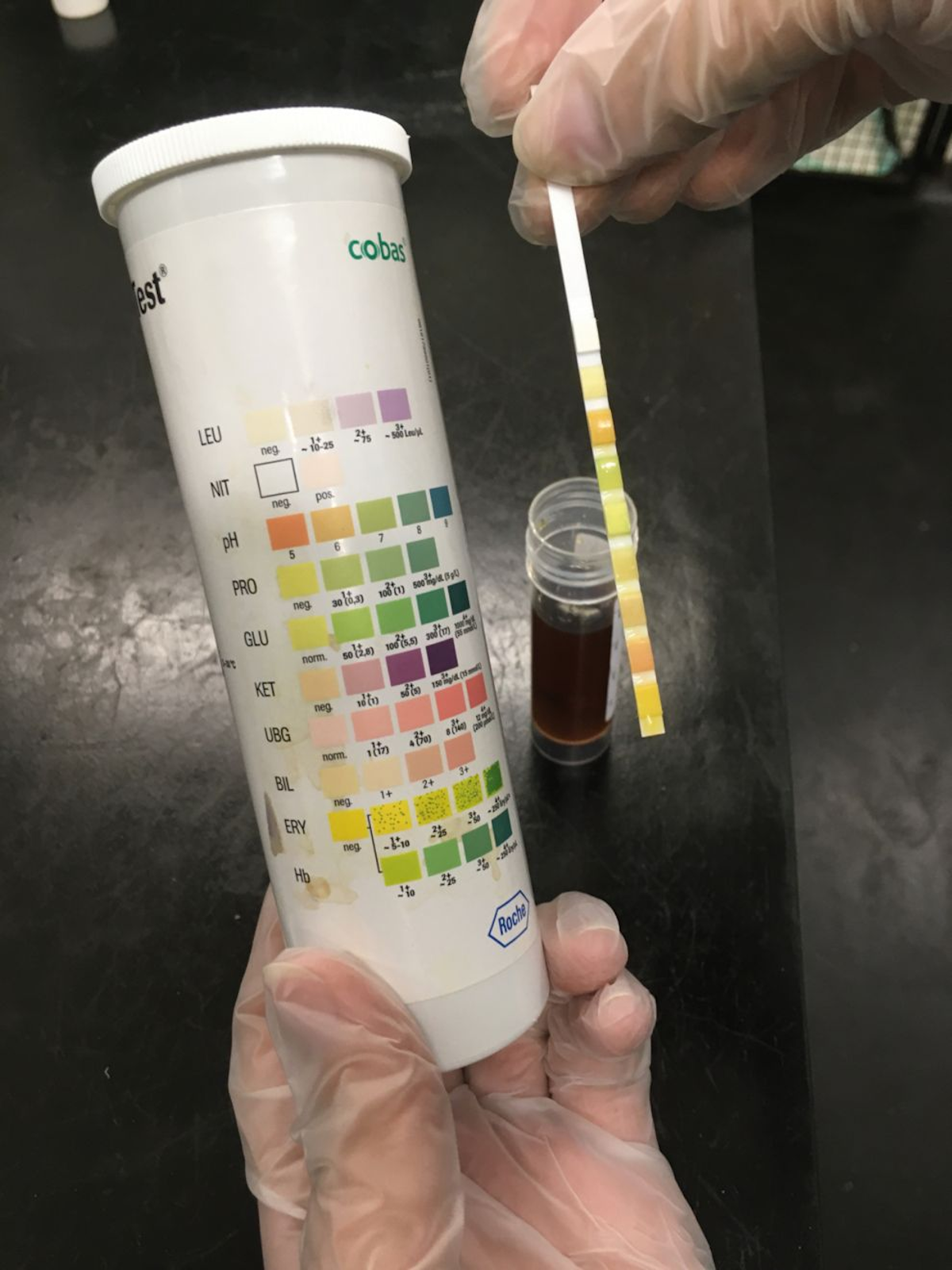 A dipstick colorimetric test to detect urinary albumin is a quick and easy method for benchtop testing; however both false negatives and false positives are common in cats. 