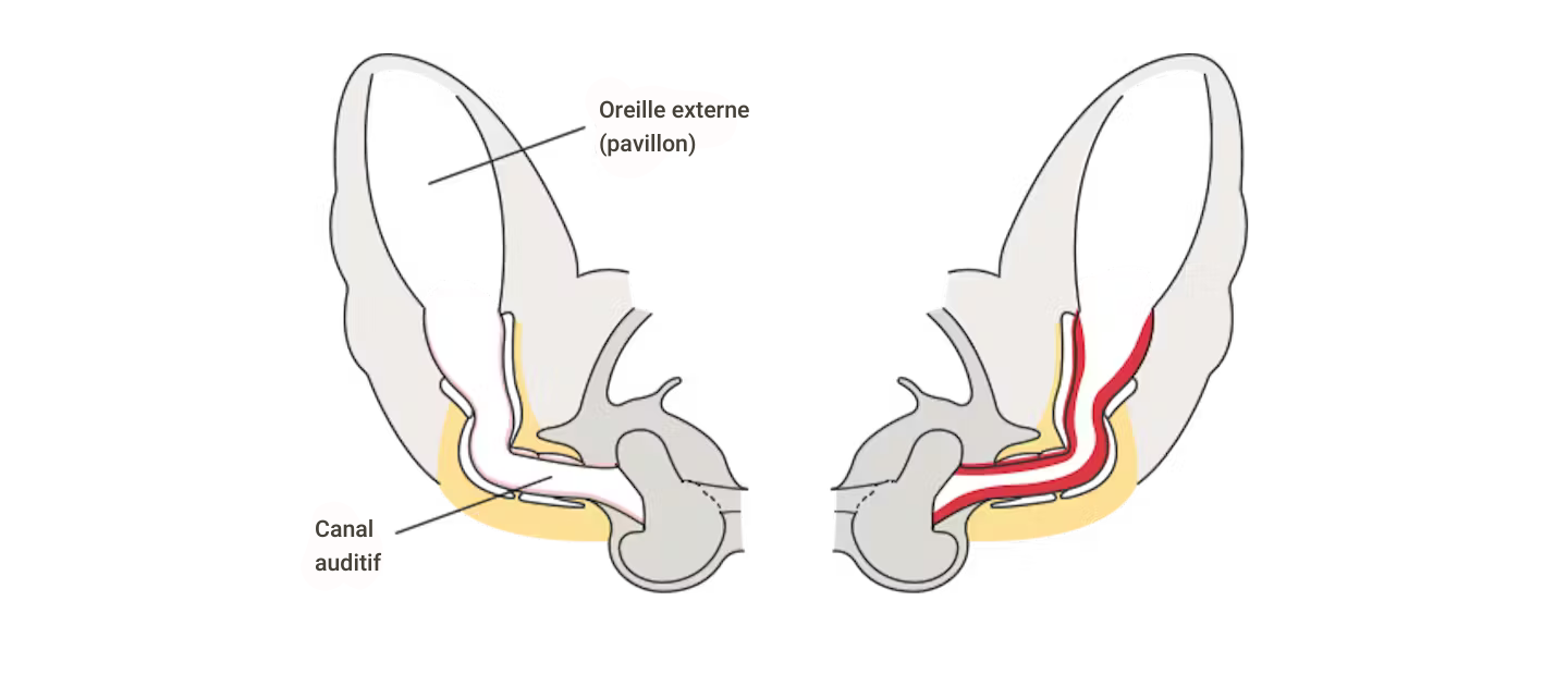 dermatology ear condition