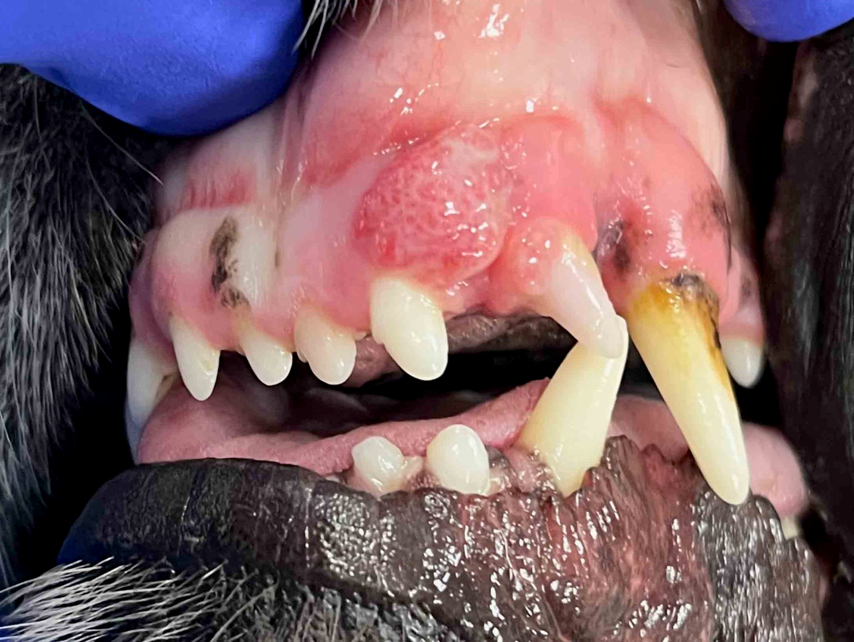 Hyperplasie gingivale ronde et de texture irrégulière associée à la gencive au niveau des dents 202 et 203