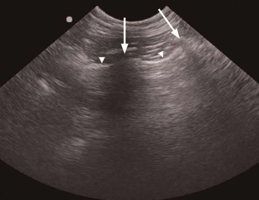 A lung ultrasound performed in a 4-year-old male neutered Domestic Shorthair cat with suspected asthma