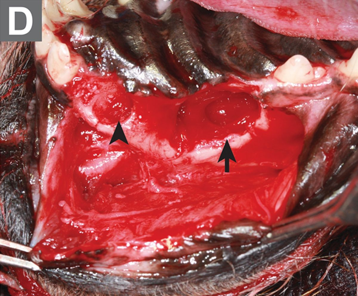 Diese intraoperative Aufnahme zeigt die geräumte Alveole des rechten maxillären I3 (Pfeilspitze), die geräumte Alveole des rechten maxillären P1 und den präparierten Flap zur Abdeckung der oronasalen Fistel an der Stelle des fehlenden rechten maxillären Caninus (Pfeil). Die orale Untersuchung der Fistel unterschätzt häufig das tatsächliche Ausmaß des Knochenverlustes. In vielen Fällen ist deshalb ein großer Flap erforderlich, um den Defekt spannungsfrei zu reparieren und dadurch die Chancen auf eine erfolgreiche endgültige Heilung zu maximieren. 