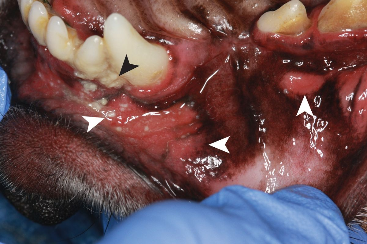 The right maxillary buccal mucosa in a Chihuahua with chronic oral ulceration (white arrowheads) consistent with chronic ulcerative paradental stomatitis. There is exuberant plaque accumulation (black arrowhead). The patient is positioned in dorsal recumbency.