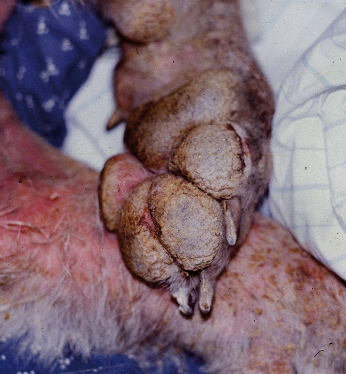 Figure 4. Couches de pustules séchées sur les coussinets d’un chien souffrant de pemphigus foliacé. © Rosanna Marsella