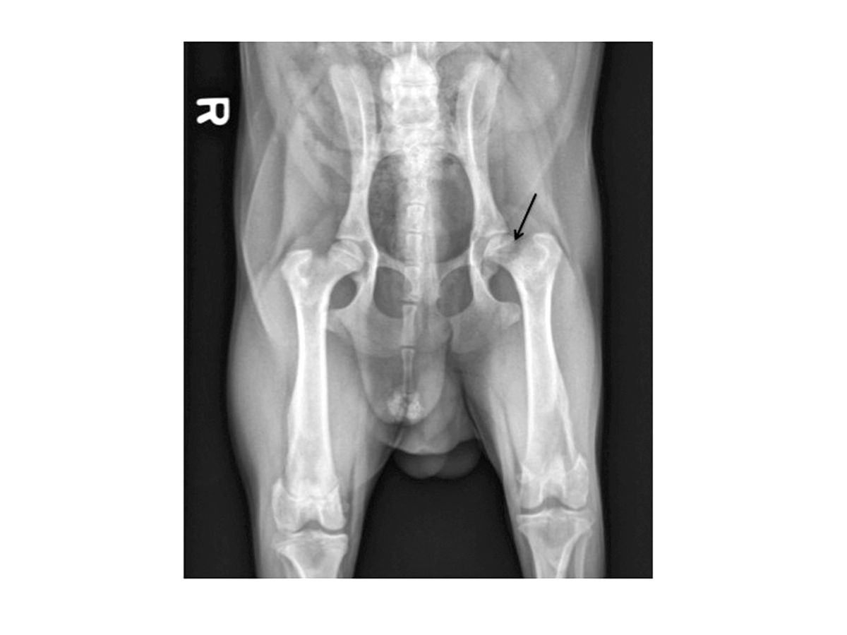 Esta radiografía muestra alteraciones moderadas de la ELCP. La flecha indica la pérdida significativa de hueso subcondral y del cuello femoral, con remodelación de la cabeza femoral.