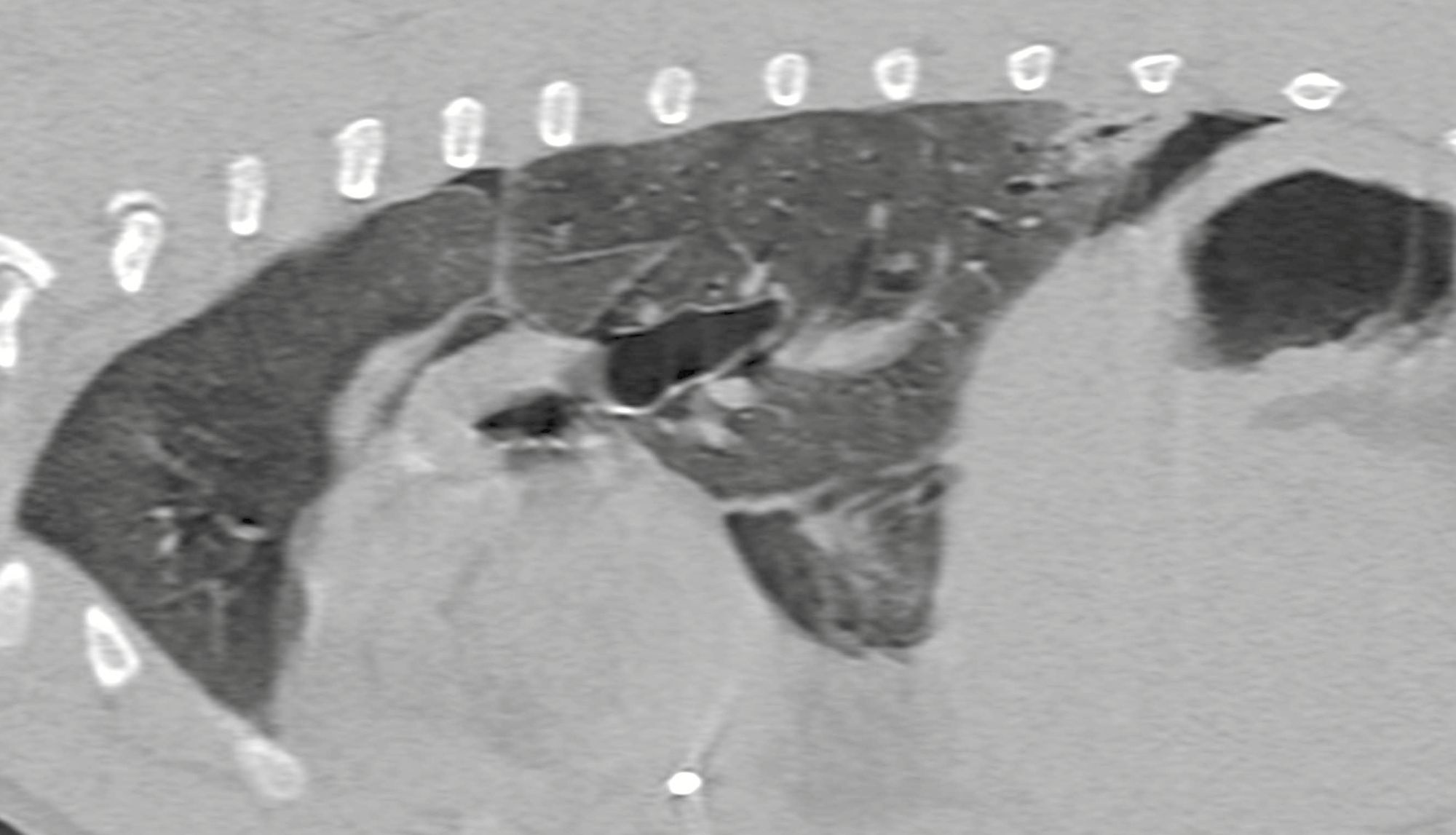 Figure 3. Vues sagittale (a) obtenues au scanner d’un chien