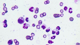 Cytology of the fluid 