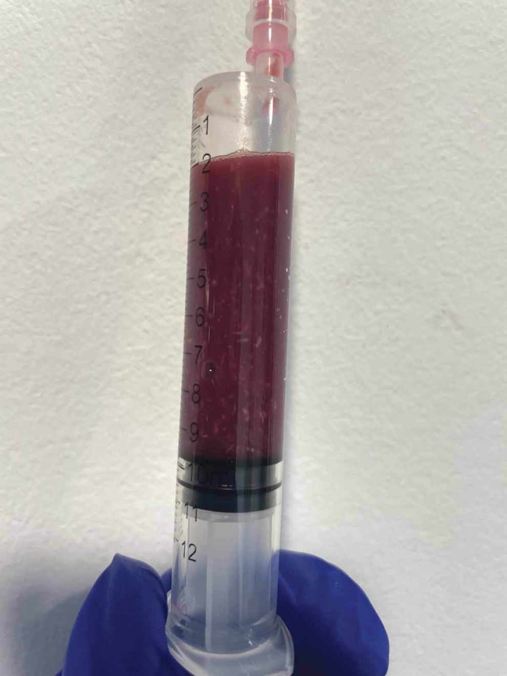Figure 4. (a) Prélèvement réalisé par abdominocentèse chez un chien