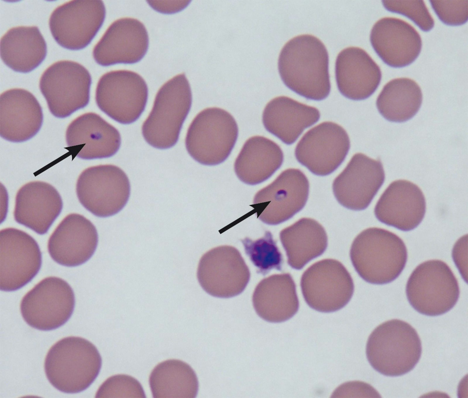 Trofozoiti intracellulari di Babesia Felis 