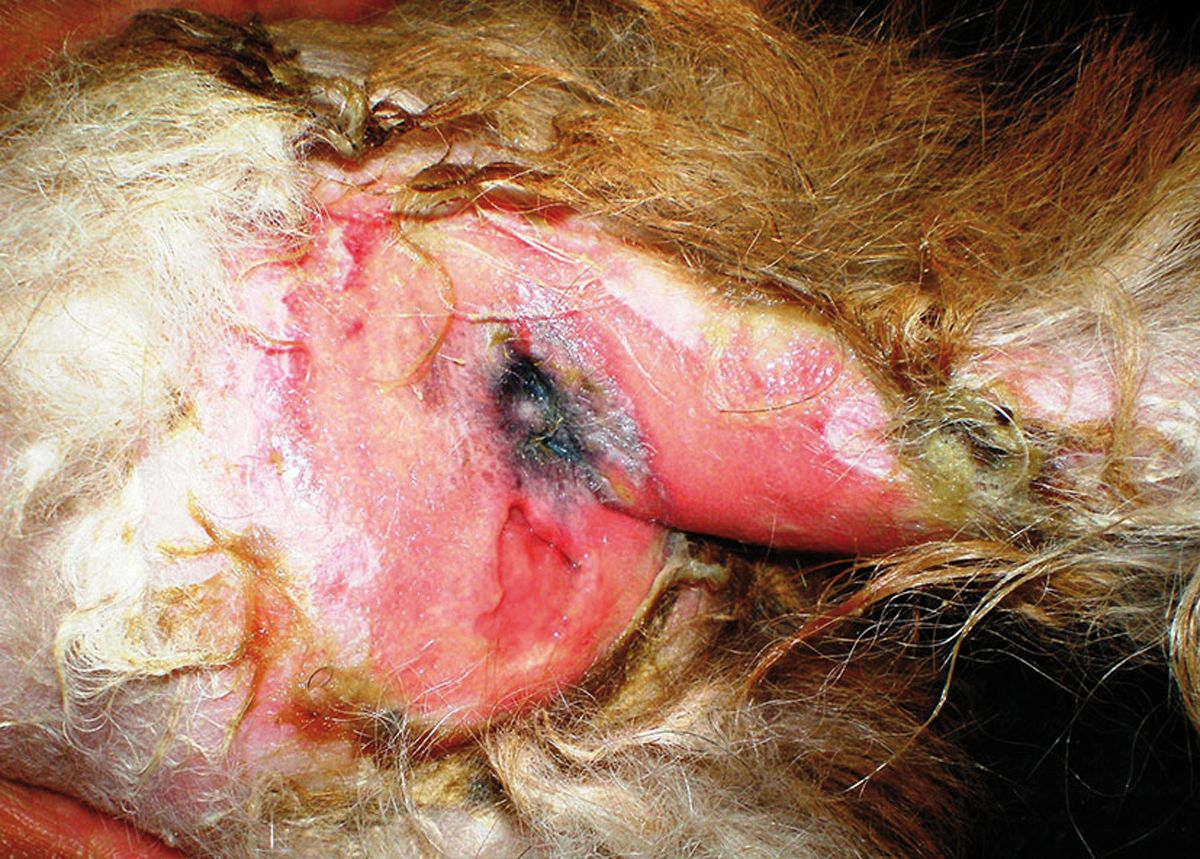 Figure 2. SND with marked perianal erosion and ulceration of the skin.© Patricia D. White
