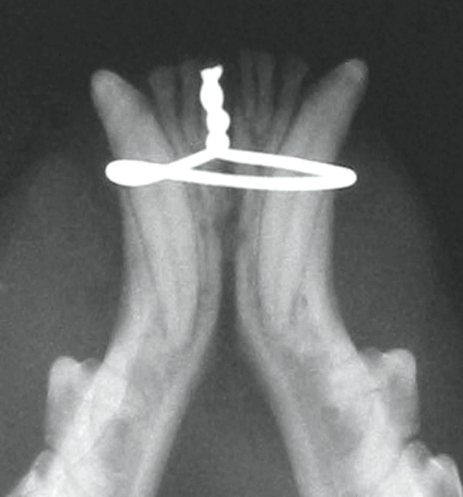 How I Approach Fractures Of The Maxilla And Mandible In 4869