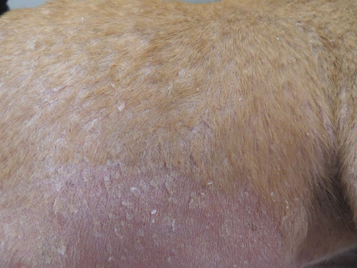Exfoliative dermatitis, with white, relatively adherent scales, is considered to be the most common dermatological presentation of leishmaniasis.