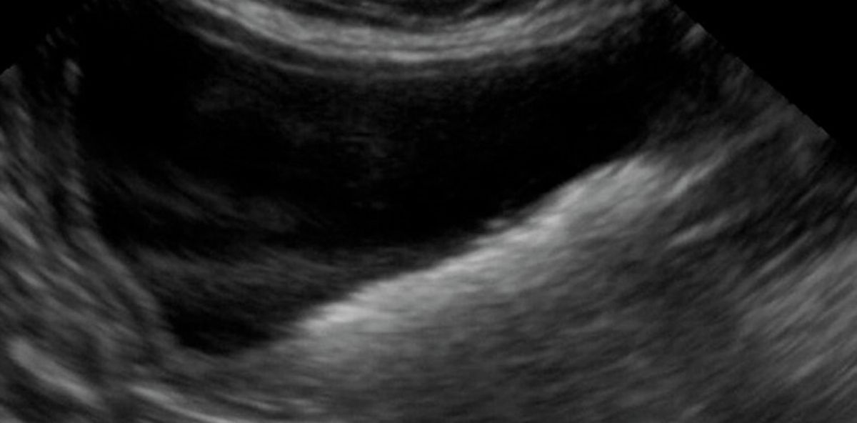 Front line ultrasound imaging of the feline urinary ...