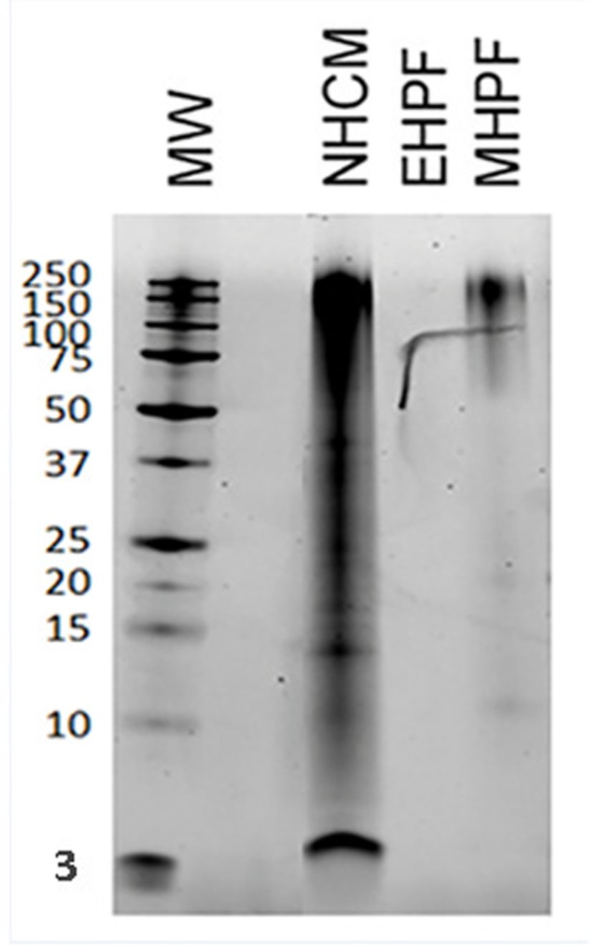 Figure 1. Protein electrophoresis on three different poultry-based raw materials, including the extensively hydrolyzed feather protein of Anallergenic diets.  Key:   • NHCM (non-hydrolyzed chicken meal): many proteins of varying molecular weight can be seen • EHPF (Anallergenic extensively hydrolyzed poultry feather): no band seen • MHPF (mildly hydrolyzed poultry feather): residual large proteins are seen • MW: molecular weight in kilodaltons (kDa)  Note: Free amino acids are not visualized by this technique. The artefact on the gel was a deposit before migration.