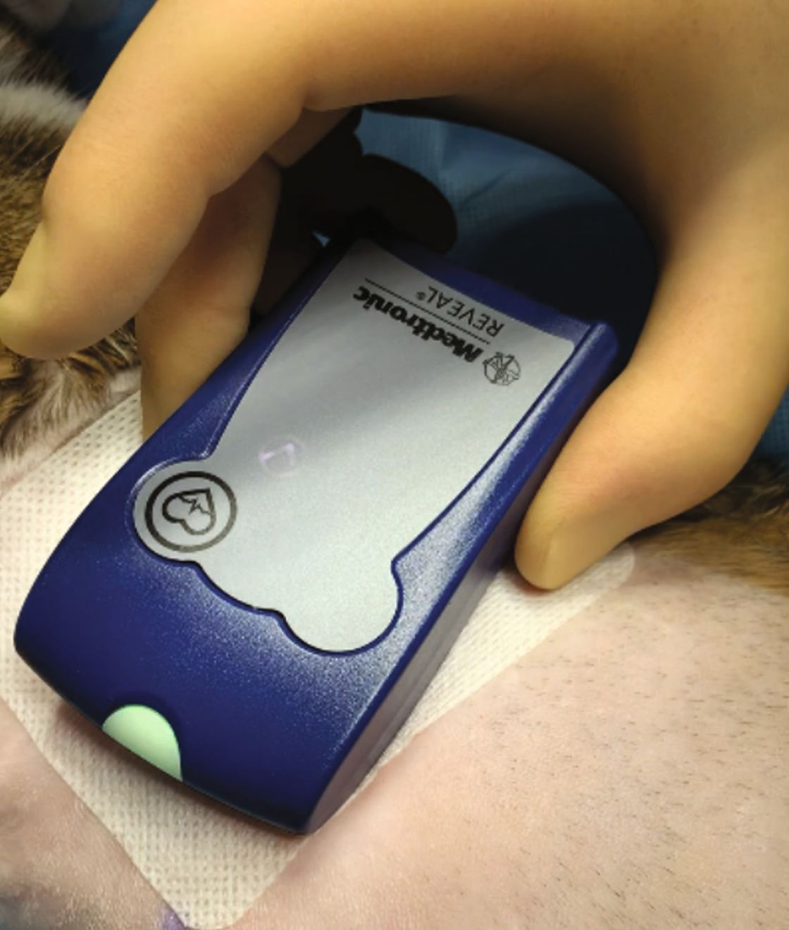 La fonctionnalité du dispositif a été testée pendant l’intervention à l’aide d’un programmateur du pacemaker et d’un dispositif d’activation dédié au chat