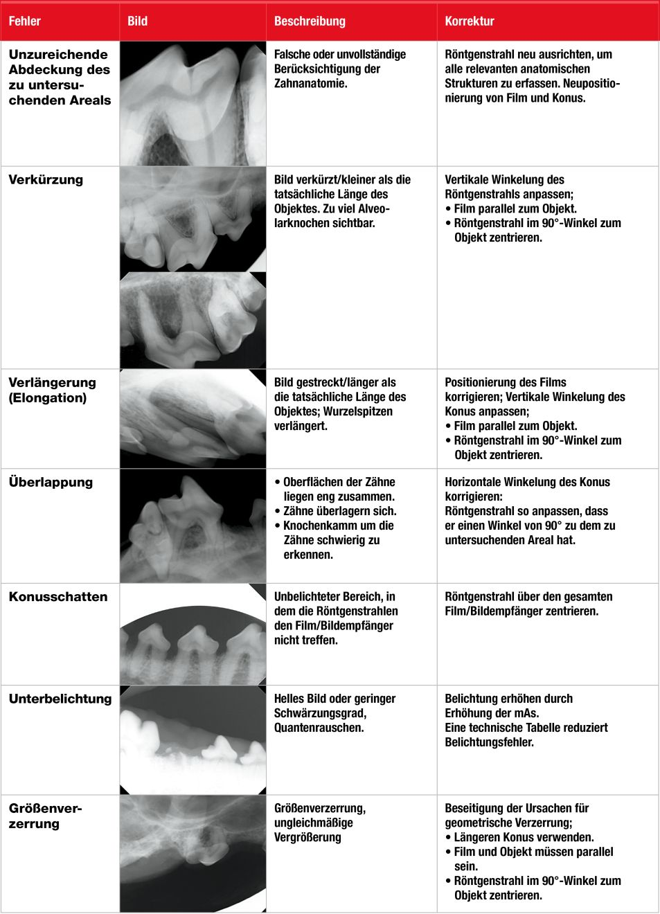 Tabelle 1. Häufige Fehler in der Dentalradiographie.
