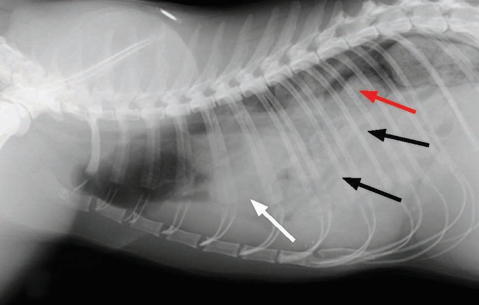 normal diaphragmatic line 