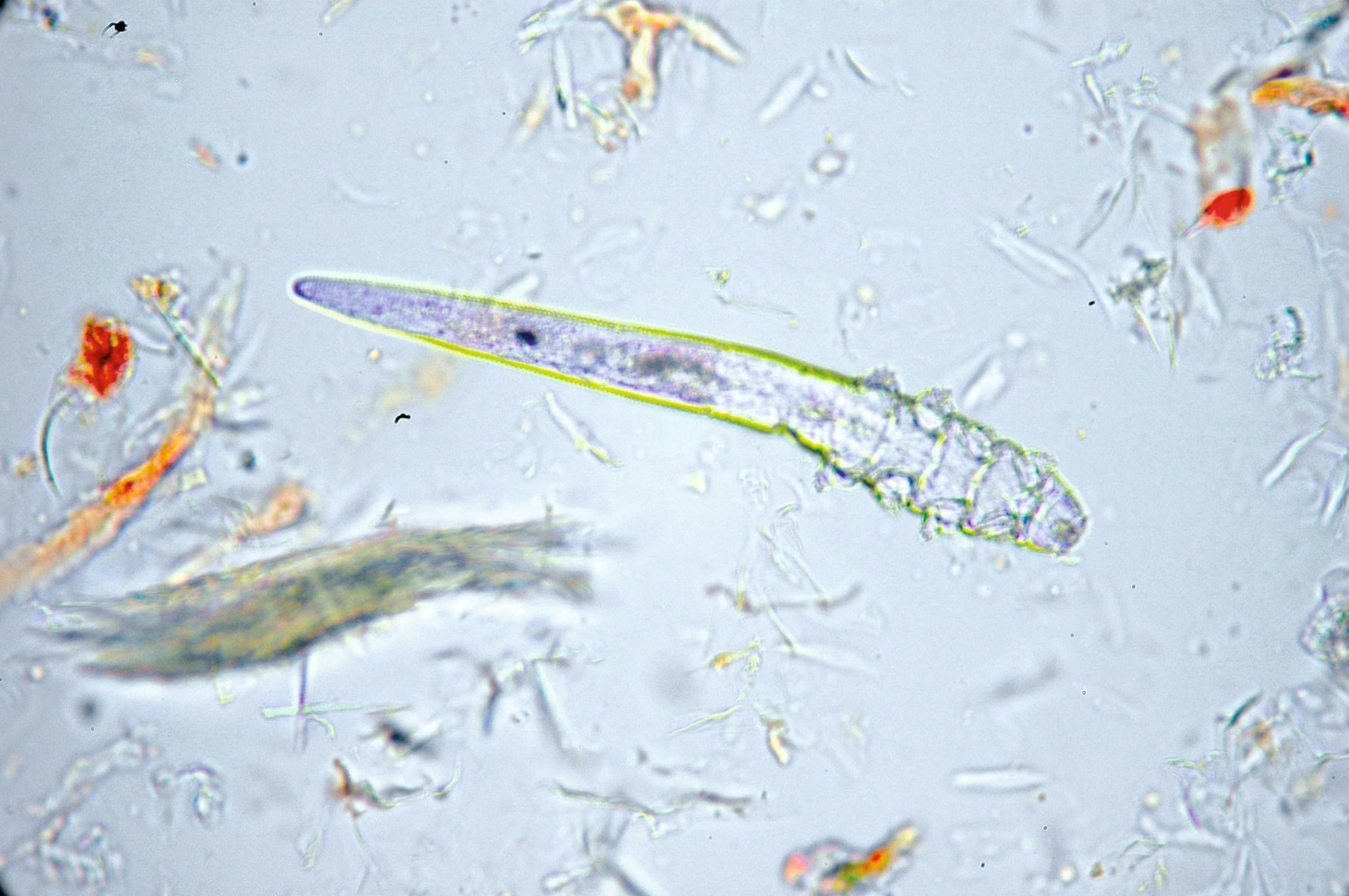 Demodex can present as a severe erythroderma, earning it the title “red mange”.