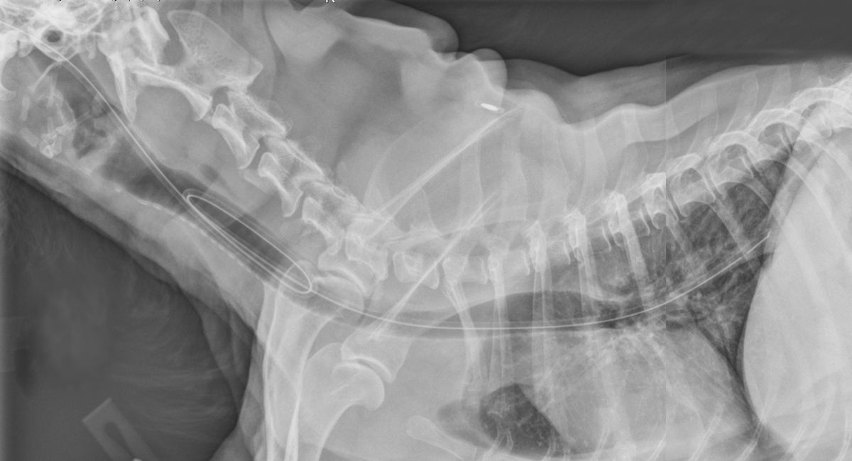 Il metodo migliore per controllare la posizione della sonda per la nutrizione è una radiografia toracica laterale. Questa immagine è la combinazione di due radiografie separate e mostra una sonda nasale che ha formato un anello ed è entrata accidentalmente nella trachea.