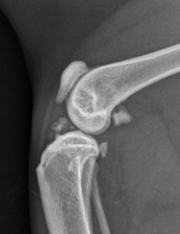 Figura 3. Imagens representativas demonstrando as alterações radiográficas comumente associadas à osteoartrite felina. Na visão ventrodorsal dos quadris (a), pode-se apreciar a formação de osteófitos nas margens acetabulares craniodorsais, além do remodelamento das cabeças femorais. Na visão mediolateral do cotovelo (b), pode-se apreciar um aumento da opacidade óssea subcondral na região peritrocilar, além da formação de osteófitos periarticulares. Na visão mediolateral do joelho (c), pode-se apreciar mineralização intra-articular e efusão sinovial. © Karen Perry