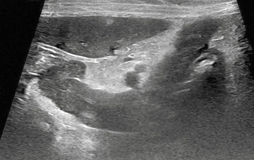 Image échographique de la partie gauche du pancréas chez un chat présentant une perte de poids inexpliquée et une augmentation intermittente de l’immunoréactivité de la lipase pancréatique spécifique du chat